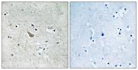 Ephrin-B1/2 (phospho Tyr329) Polyclonal Antibody