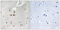 Ephrin-B1/2/3 (phospho Tyr324) Polyclonal Antibody