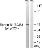 Ephrin-B1/2/3 (phospho Tyr324) Polyclonal Antibody
