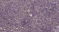 Atm (phospho Ser1981) Polyclonal Antibody