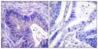 ATP-citrate synthase (phospho Ser455) Polyclonal Antibody