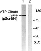 ATP-citrate synthase (phospho Ser455) Polyclonal Antibody