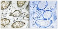 ATR (phospho Ser428) Polyclonal Antibody