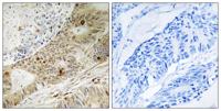 ATRIP (phospho Ser224) Polyclonal Antibody