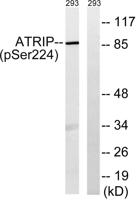 ATRIP (phospho Ser224) Polyclonal Antibody