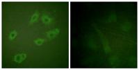 ErbB-3 (phospho Tyr1222) Polyclonal Antibody