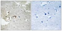 Axl (phospho Tyr691) Polyclonal Antibody