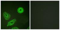 ErbB-3 (phospho Tyr1289) Polyclonal Antibody