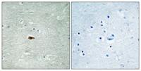ErbB-3 (phospho Tyr1328) Polyclonal Antibody