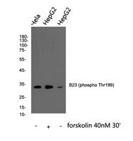B23 (phospho Thr199) Polyclonal Antibody