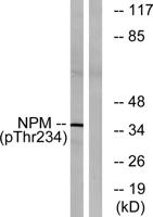 B23 (phospho Thr234) Polyclonal Antibody