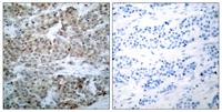 Bad (phospho Ser112) Polyclonal Antibody