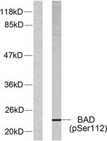 Bad (phospho Ser112) Polyclonal Antibody