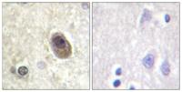 Bad (phospho Ser134) Polyclonal Antibody