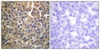 ErbB-4 (phospho Tyr1284) Polyclonal Antibody