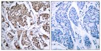Bad (phospho Ser155) Polyclonal Antibody