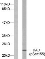 Bad (phospho Ser155) Polyclonal Antibody