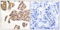 Bad (phospho Ser91) Polyclonal Antibody