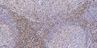 BAM32 (phospho Tyr139) Polyclonal Antibody