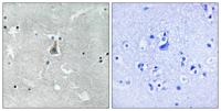 Bax (phospho Ser184) Polyclonal Antibody