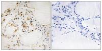 Bcl-2 (phospho Ser87) Polyclonal Antibody