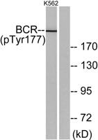 Bcr (phospho Tyr177) Polyclonal Antibody