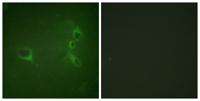 Bcr (phospho Tyr360) Polyclonal Antibody