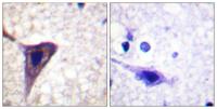 BID (phospho Ser78) Polyclonal Antibody