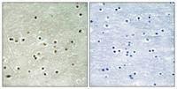 MCM4 (phospho Ser54) Polyclonal Antibody