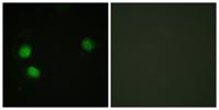 BLM (phospho Thr99) Polyclonal Antibody