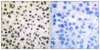 MEF-2 (phospho Ser408) Polyclonal Antibody