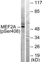 MEF-2 (phospho Ser408) Polyclonal Antibody