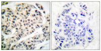 MEF-2 (phospho Thr319) Polyclonal Antibody