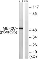 MEF-2C (phospho Ser396) Polyclonal Antibody