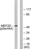MEF-2D (phospho Ser444) Polyclonal Antibody