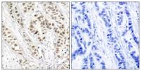 BRCA1 (phospho Ser1524) Polyclonal Antibody