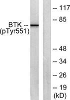 Btk (phospho Tyr551) Polyclonal Antibody