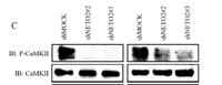 CaMKIIα/β/δ (phospho Thr305) Polyclonal Antibody