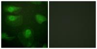 CaMKIα (phospho Thr177) Polyclonal Antibody