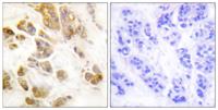 CaMKIα (phospho Thr177) Polyclonal Antibody