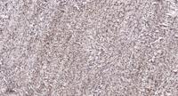Casein Kinase IIα (phospho Tyr255) Polyclonal Antibody