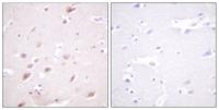 Casein Kinase IIβ (phospho Ser209) Polyclonal Antibody
