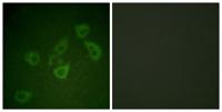 Caspase-6 (phospho Ser257) Polyclonal Antibody