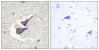 Catalase (phospho Tyr386) Polyclonal Antibody
