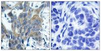 Catenin-β (phospho Ser33) Polyclonal Antibody