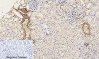 Catenin-β (phospho Ser37) Polyclonal Antibody