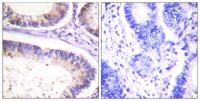 Cbl (phospho Tyr674) Polyclonal Antibody