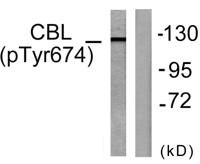 Cbl (phospho Tyr674) Polyclonal Antibody