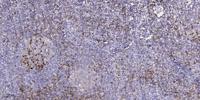 MARK1/2/3/4 (phospho Thr215) Polyclonal Antibody