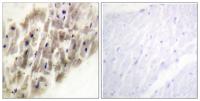 MAPKAPK-2 (phospho Thr222) Polyclonal Antibody